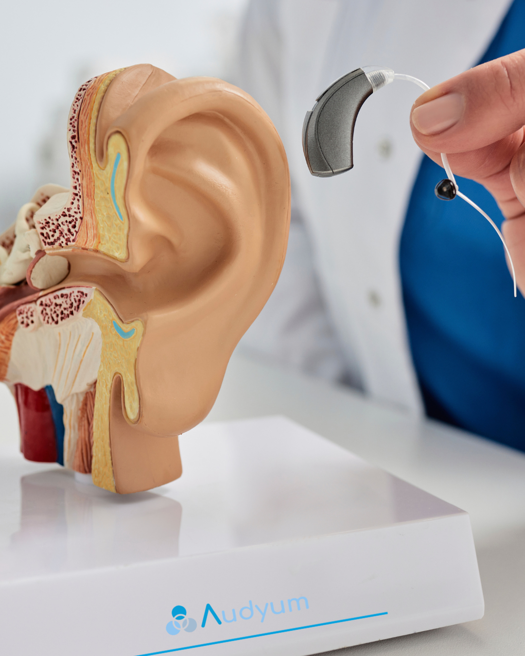 Custom Hearing Aid Molds vs Universal Domes